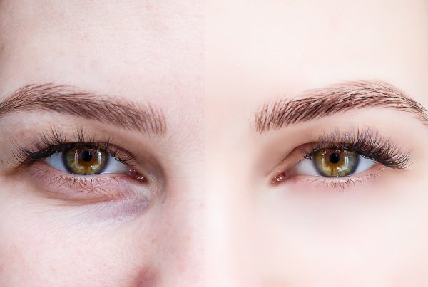 eyebrows after microblading